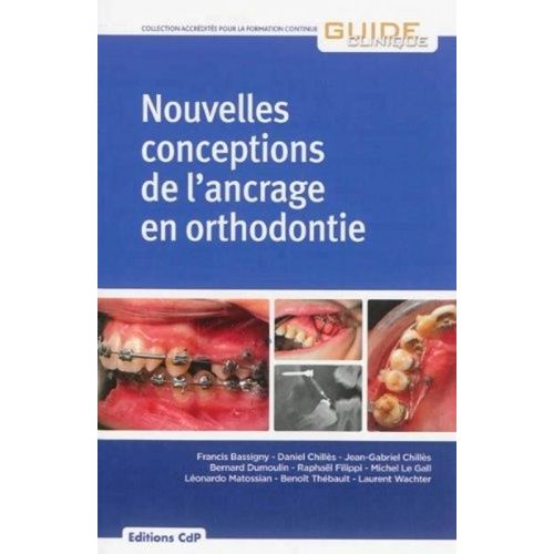 Nouvelles Conceptions De L'ancrage En Orthodontie