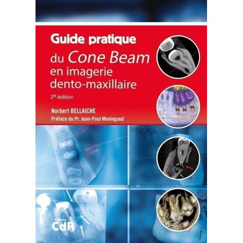 Guide Pratique Du Cone Beam