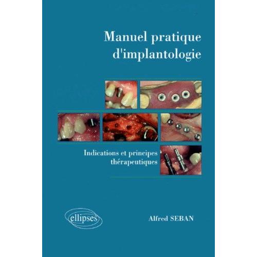 Manuel Pratique D'implantologie - Indications Et Principes Thérapeutiques