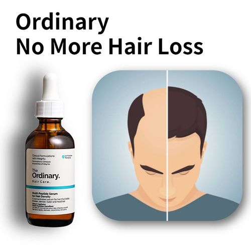 Huiles Essentielles Pour La Croissance Des Cheveux, Soin Pour Améliorer La Perte De Cheveux, Liquide, Traitement Peptidique, Sérum De Croissance Capillaire, Protection Capillaire Originale 