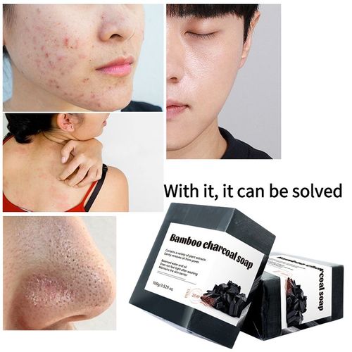 Savons Artisan Au Charbon De Bambou Naturel, Huile De Contrôle Des Pores D'aleans, Blanchiment De La Peau, Acné, Glutathion, Élimine Les Taches Noires, Regina 