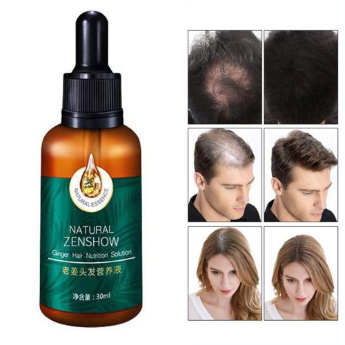 Sérum De Croissance Des Cheveux Naturels, Huile Essentielle Pour Réparation Des Cheveux Endommagés, Soins Pour La Prévention Des Cheveux Secs 