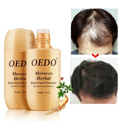 Crème Revitalisante Pour Les Cheveux, Soin Capillaire, Réparation Des Racines Des Cheveux, Essence De Ginseng, Multifonctionnelle, Nourrissante 