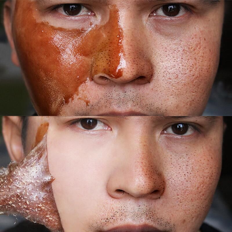 Masque De Nettoyage De Peau Morte, Rtrcissement Des Pores,... - 2