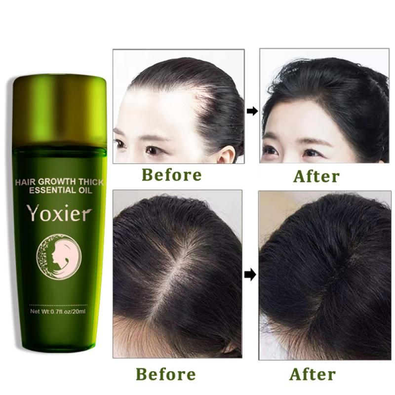Shampoing  L'huile Pour La Croissance Des Cheveux, 20ml, So... - 4