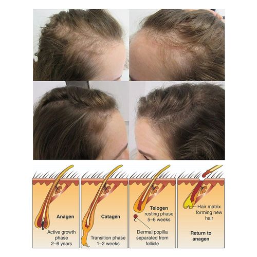 Savon De Riz Pour Cheveux, Soins Pour Cheveux, Hydratant, Croissance Rapide, Anti-Chute, Lavage Des Cheveux, Parfum Floral, Shampoing Au Riz 