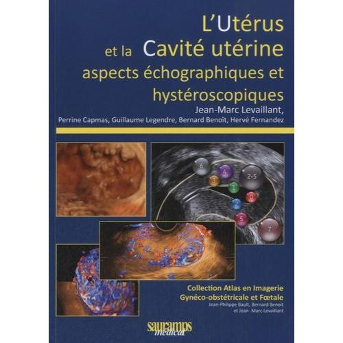 L'utérus Et La Cavité Utérine - Aspects Échographiques Et Hystéroscopiques