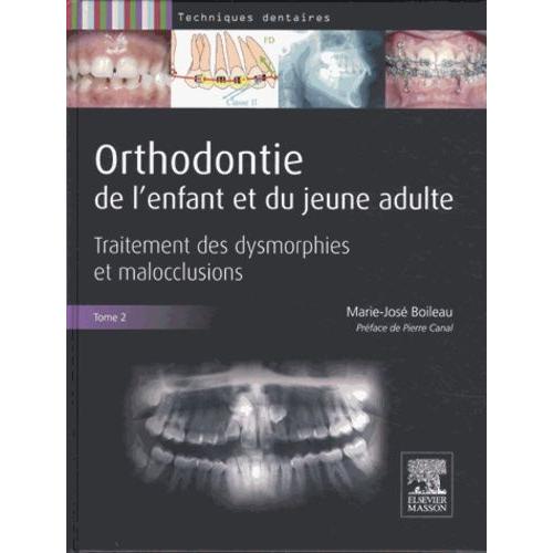 Orthodontie De L'enfant Et Du Jeune Adulte - Tome 2, Traitement Des Dysmorphies Et Malocclusions