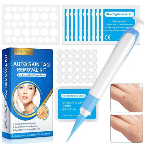 Dissolvant Automatique D'étiquettes De Peau, Outil D'élimination Indolore Des Verrues, Kit D'élimination Des Verrues Avec Patch De Réparation, Lingettes Nettoyantes Pour Petites Et Grandes Peaux 