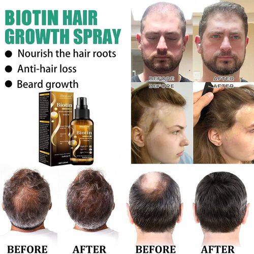 Huile De Soins Capillaires, Sérum De Croissance Capillaire, Anti-Perte De Cheveux, Nourrit Le Cuir Chevelu 