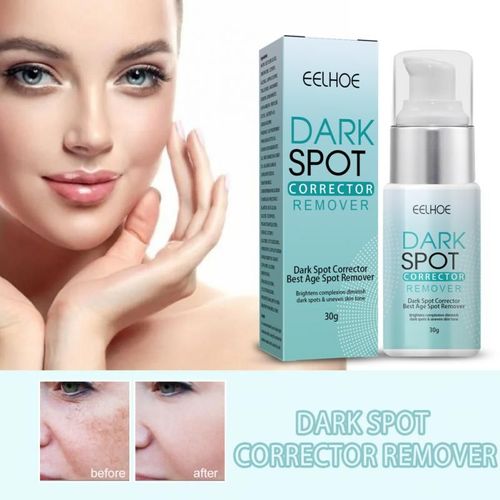 Crème Blanchissante À Base De Nicotinamide, Dissolvant De Taches Foncées, Produits De Soins Pour La Peau, Hydratant, Éclaircissant, Correcteur De Pigment, Beauté Du Visage 