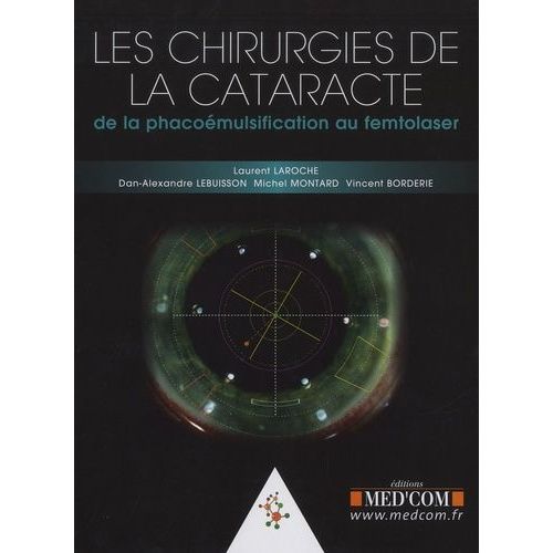 Les Chirurgies De La Cataracte - De La Phacoémulsification Au Femtolaser