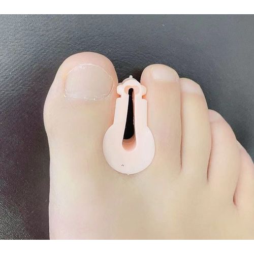 2pcs = 1pair Hot Toe Orthosis Clip Pads Big Foot Bone Care Tools Splitter Thumb Hallux Valgus Bunion Correcteur De Recouvrement Splitter - Type Hf275-Brighten Skin