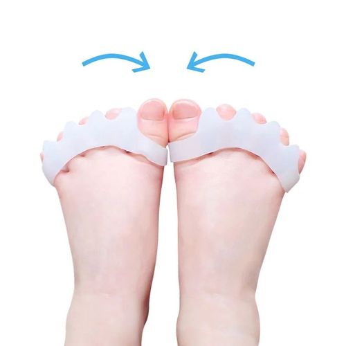Mathiateur D'hallux Valgus Pour Pédicure,100 Pièces = 50 Paires,Orth4wd - Type White For Kid