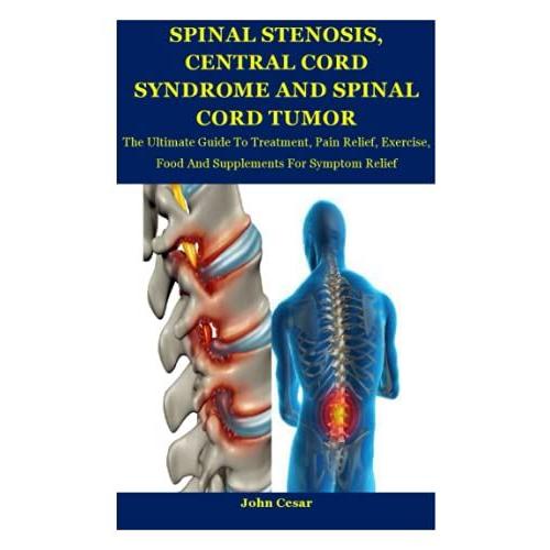 Spinal Stenosis, Central Cord Tumor And Spinal Cord Syndrome: The Ultimate Guide To Treatment, Pain Relief, Exercise, Food And Supplements For Symptom Relief