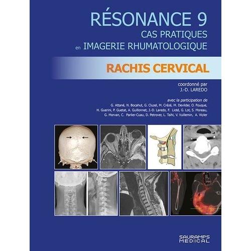 Résonance - Tome 9, Cas Pratiques En Imagerie Rhumatologique : Rachis Cervical