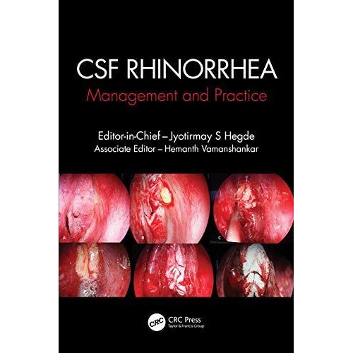 Csf Rhinorrhoea