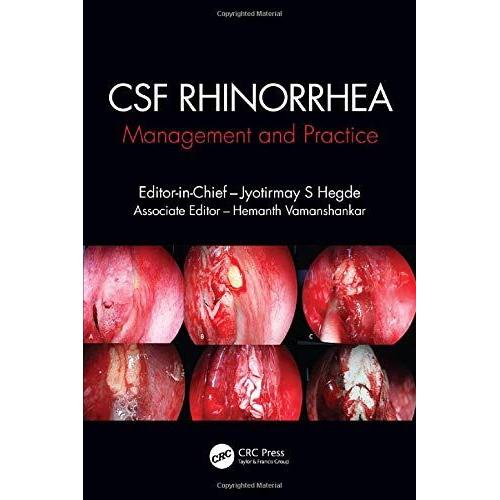 Csf Rhinorrhoea