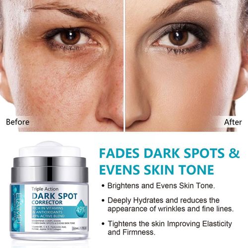 Correcteur De Taches Foncées 50ml, Crème Réparatrice, Hydratante, Dissolvant De Taches Foncées Pour Femmes Et Hommes, Anti-Âge, Élimination Des Taches De Rousseur, R7x0 