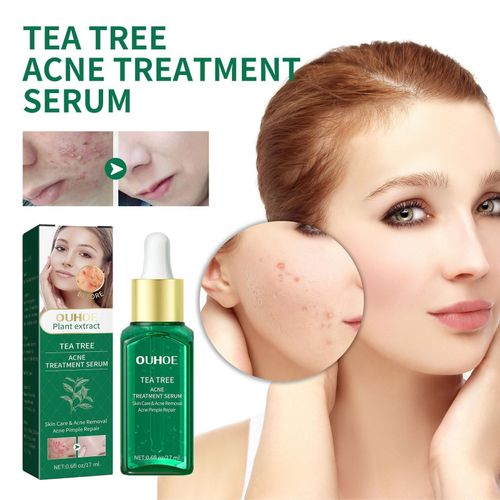 Sérum De Traitement Pour Le Visage, Anti-Acné, Dissolvant De Cicatrice, Essence De Peau, Hydratant, Crème De Soin Blanchissante, 17ml, L2u6 