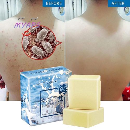 Savon Au Lait De Chèvre Au Sel De Mer, Nettoyant Pour Le Visage, Dissolvant D'acné, Ouverture Des Pores, 60g 