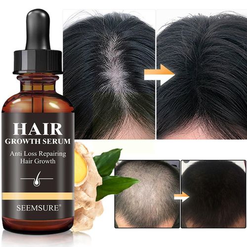 Huiles Essentielles À Croissance Rapide Pour Cheveux Au Gingembre, 30ml, Soins Pour Cheveux Abîmés Et Frisés, Séchage Rapide, T4w1 