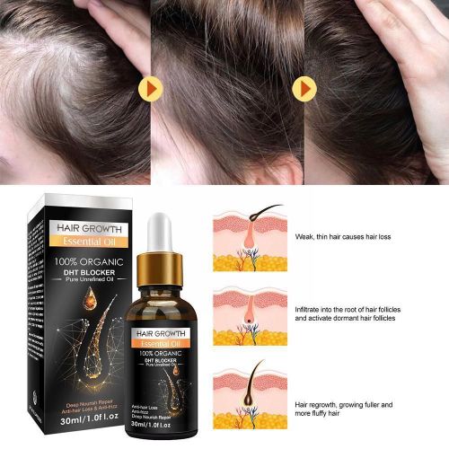 Produits Naturels Pour La Croissance Des Cheveux, Soins Pour Les Cheveux Endommagés, Nourrissant, Contre La Calvitie, Séchage Rapide, O1u9 