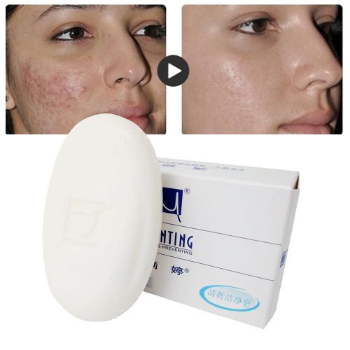 Savon De Bain Éclaircissant Pour La Peau, 100g, Acarus Acari, Élimine Les Bactéries, Les Imperfections, Savon De Bain, Traitements De Nettoyage, Champignons 