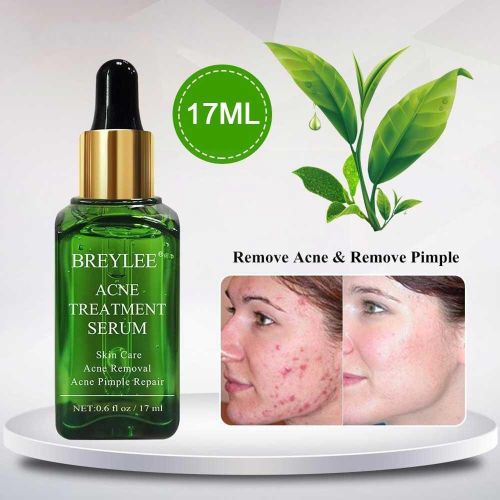 Sérum De Traitement De L'acné Pour Le Visage, Crème Anti-Cicatrice Et Anti-Taches, Soin De Réparation, Blanchissant, Élimination De La Peau, Dissolvant D'acné, 17ml, O1j8 