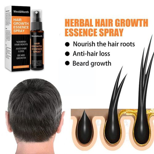 Huiles Essentielles En Spray Pour La Croissance Des Cheveux, 30ml, Soins Pour La Prévention Du Cuir Chevelu, Perte De Cheveux, Beauté, J0h0 