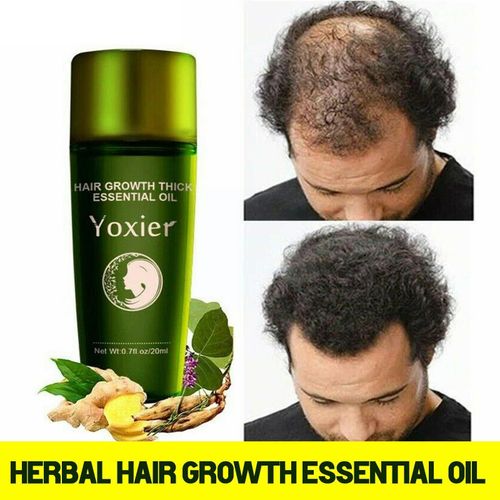 Soins Capillaires À Base De Plantes, Huile Essentielle, Anti-Perte De Cheveux, Soins Du Cuir Chevelu, Gingembre, Réparation Anti-Casse, Anti-Séchage, 20ml, S3q7 