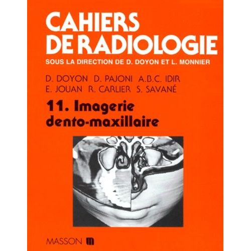 Cahiers De Radiologie Tome 11 - Imagerie Dento-Maxillaire
