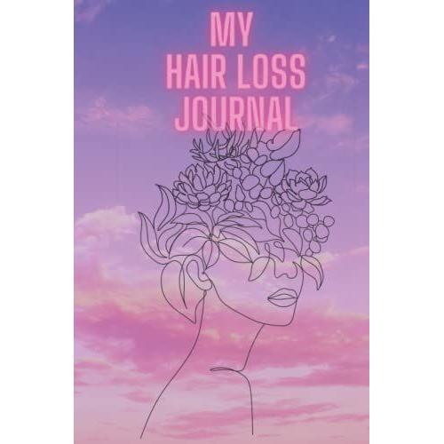 My Hair Loss Journal: Helpful Journal For Hair Loss/Hair Regrowth