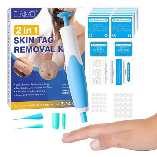 Kit De Dissolvant D'étiquettes De Peau Indolore, Stylo Dissolvant D'étiquettes De Peau Facile À Enlever, Dispositif À Remove2mm-8mm Étiquettes De Peau, Sûr Et Efficace Pour 