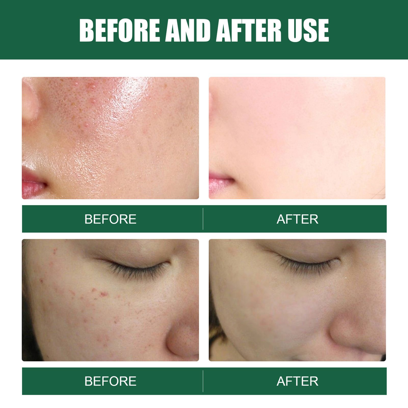 Savon Nettoyant Pour Le Visage En Barre D'absinthe, Pour Tou... - 4