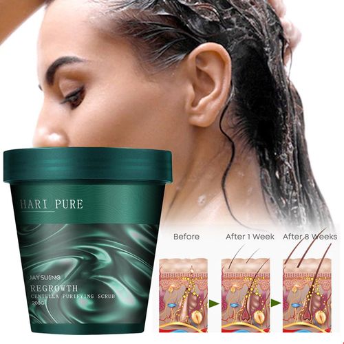 Centella Puryfing-Gislande Au Sel De Mer Pour Cheveux Abîmés, Traitements Du Cuir Oral Elu, Shampooing Anti-Pelliculaire, Contrôle De L'huile, Pour La Croissance Capillaire 