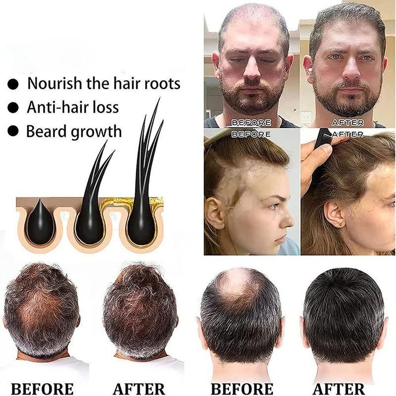 Shampooing Nourrissant  Base De Polygonum De Regina, Soins ... - 4