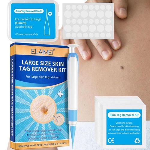 Kit De Dissolvant D'étiquettes De Peau Indolore, Stylo Pour Enlever Les Étiquettes De Peau, Dispositif Facile À Enlever (4mm-9mm), Efficace Pour 