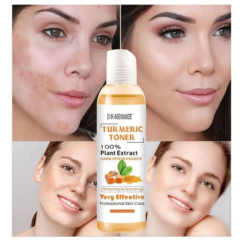 Correcteur De Taches Foncées Tumeric, Dissolvant D'acné, Pour La Peau Foncée, 118ml 