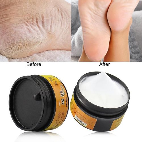 Crème Réparatrice À L'huile De Cheval, Produit De Soin Pour La Peau, Anti-Séchage, Anti-Fissure, Forte, Efficace, Pour Le Talon, Dissolvant De Peau Morte, Gommage Des Pieds 