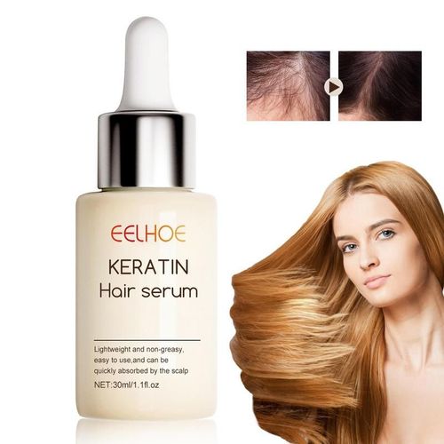 Extrait De Spray Pour La Croissance Des Cheveux, Essence De Plante Naturelle Pour Prévenir La Chute Des Cheveux, Produit De Soin Pour La Perte De Cheveux, Huiles Fortes Pour Raffermir Les Cheveux 