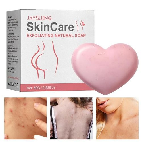 Savon De Bain Exfoliant Élimine L'acné, 80g, Dilue Les Marques D'acné, Hydrate, Nettoyant Pour La Peau, Soins Pour La Peau 