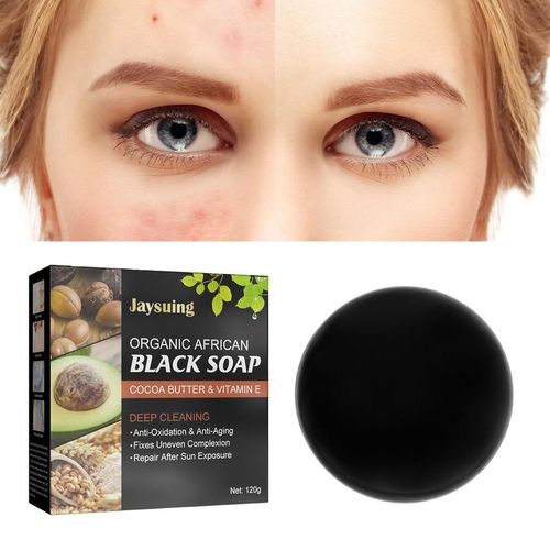 Savon En Barre Pour Le Visage Et Le Corps, Soins Pour La Peau, Contrôle Du Sébum, Blanchissant, Nettoyant Naturel Pour Peaux Sèches Et Grasses, Boutons 