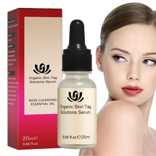 Dissolvant De Grains De Beauté, Huile Essentielle, Correcteur De Grains De Beauté, Pour Verrues Du Visage Et Du Corps 