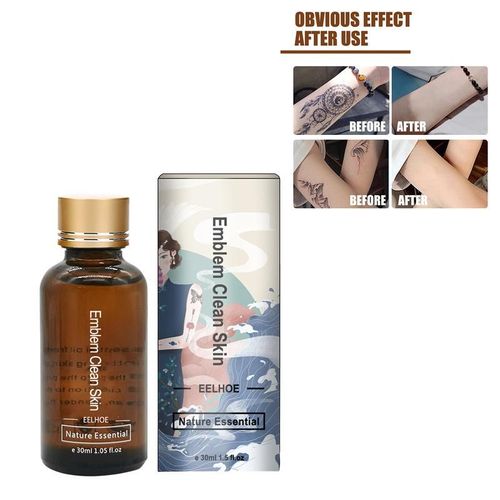 Dissolvant De Tatouage 30ml 4 Semaines, Système De Décoloration Naturelle, Indolore, Sûr Et Permanent, Couleur Et Noir 