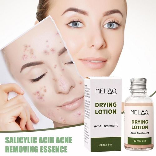 Lotion À L'essence De Rétinol, Lotion Anti-Oxyde Naturel Pour Le Visage, Dissolvant De Lignes Fines, Hydratant Pour La Peau, Sérum Correcteur De Couleur Éclaircissant 