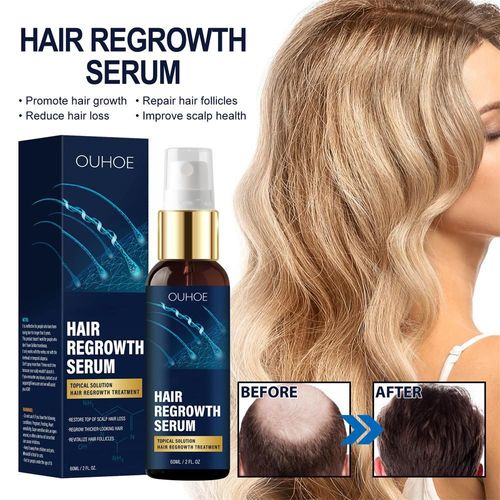 Sérum De Soins Capillaires À Croissance Rapide, Liquide Puissant Pour Prévenir La Perte De Cheveux, Accessoires Capillaires, 60ml 