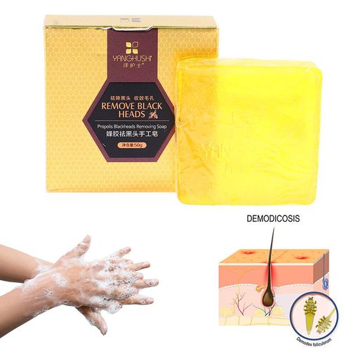 Savon De Bain Antibactérien À La Propolis, 50g, Nettoyage Du Visage, Élimination Des Acariens, Exfoliant Contre L'acné, Contrôle De L'huile, Savon Artisanal Hydratant 