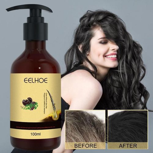 Shampooing Anti-Huile Pour Cheveux, Multi-Florum, Volumisant, Hydratant, Épaississant, Revitalisant, Améliore La Croissance, Produits De Soins Capillaires 