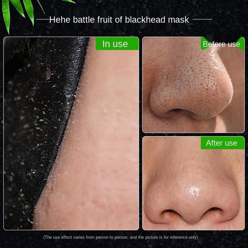 Masque Anti-Points Noirs Pour Le Nez, Dissolvant Pour Les Po... - 2